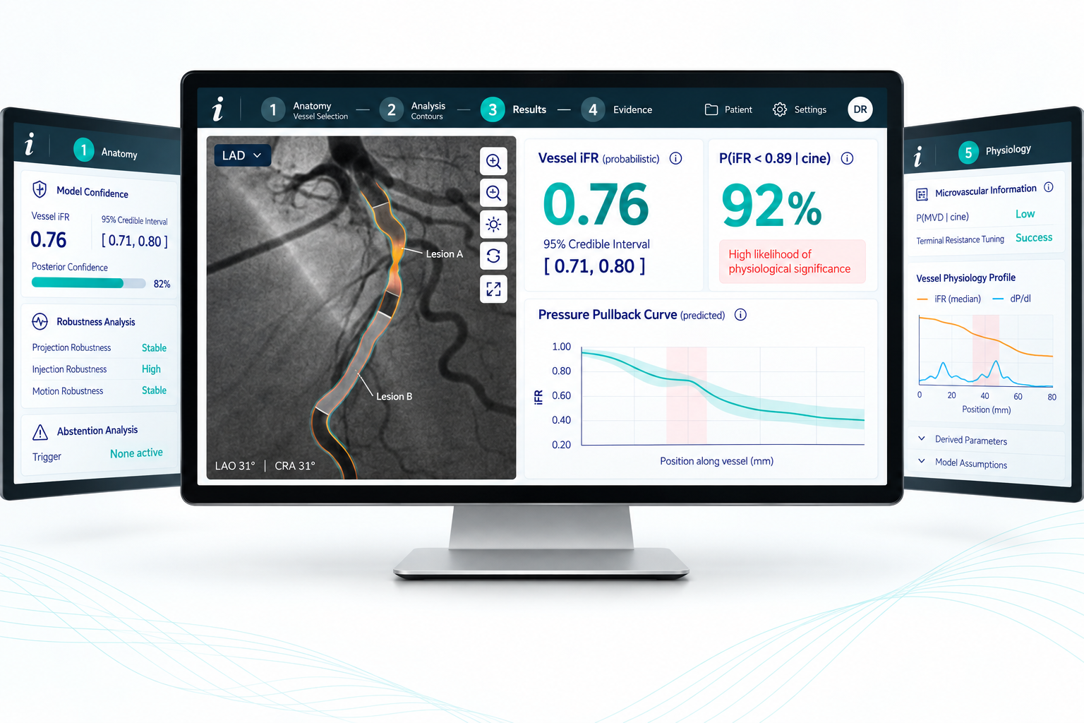 Illustrative research-stage physiology analysis interface (synthetic case)